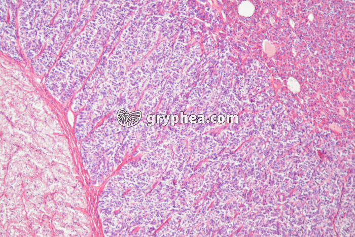 Hypophyse - Médiohypophyse avec tige pituitaire et adénohypophyse (détail) CS x 25 - gryphea.com